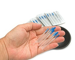 Hand holding acupuncture needles