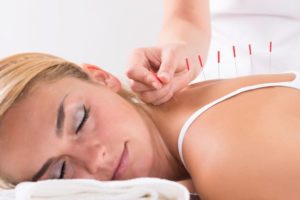 Woman relaxing during medical acupuncture treatment session